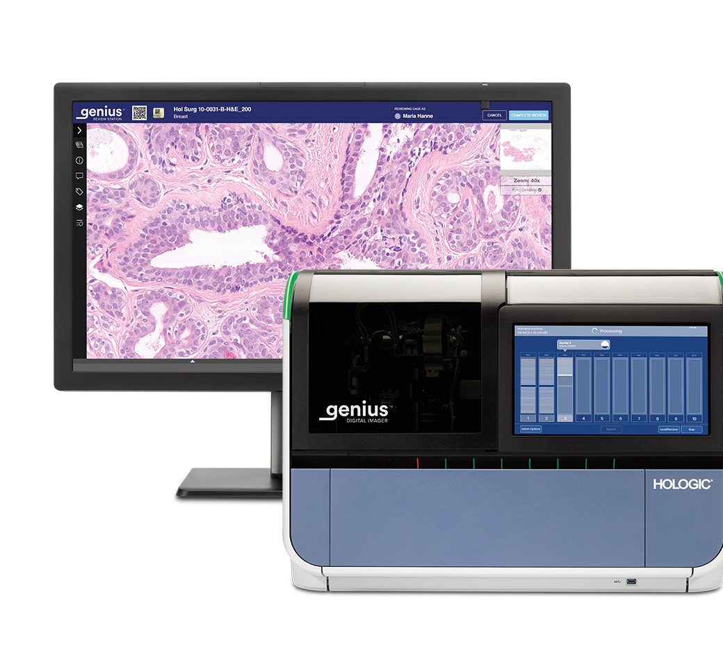 Sistema di diagnostica digitale Genius Digital Diagnostics e monitor con cellule cervicali