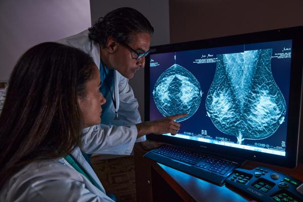 Radiologi che esaminano una mammografia con tomosintesi su un monitor