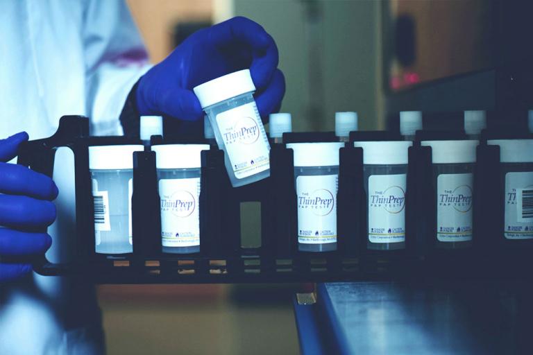 Mano con guanto che preleva un campione da un vassoio