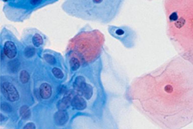 Scansione di cellule