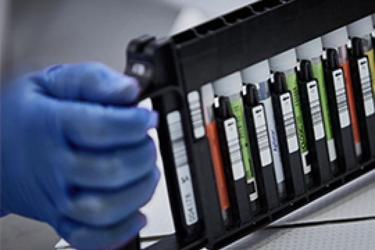 Mano con guanto che tiene un rack di provette