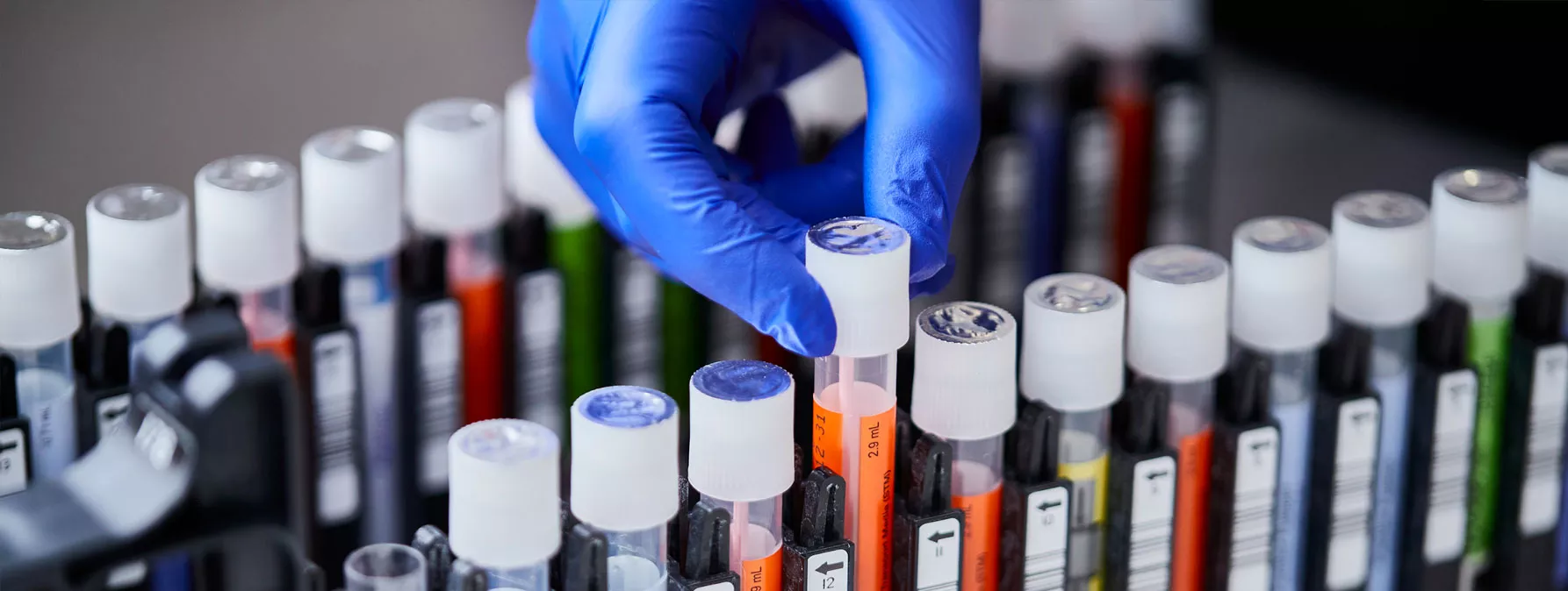 Mano con guanto che inserisce dispositivi di prelievo in un vassoio