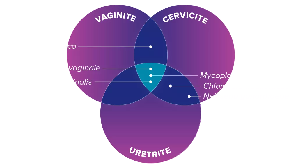 Illustrazione dei sintomi di vaginite, cervicite, uretrite