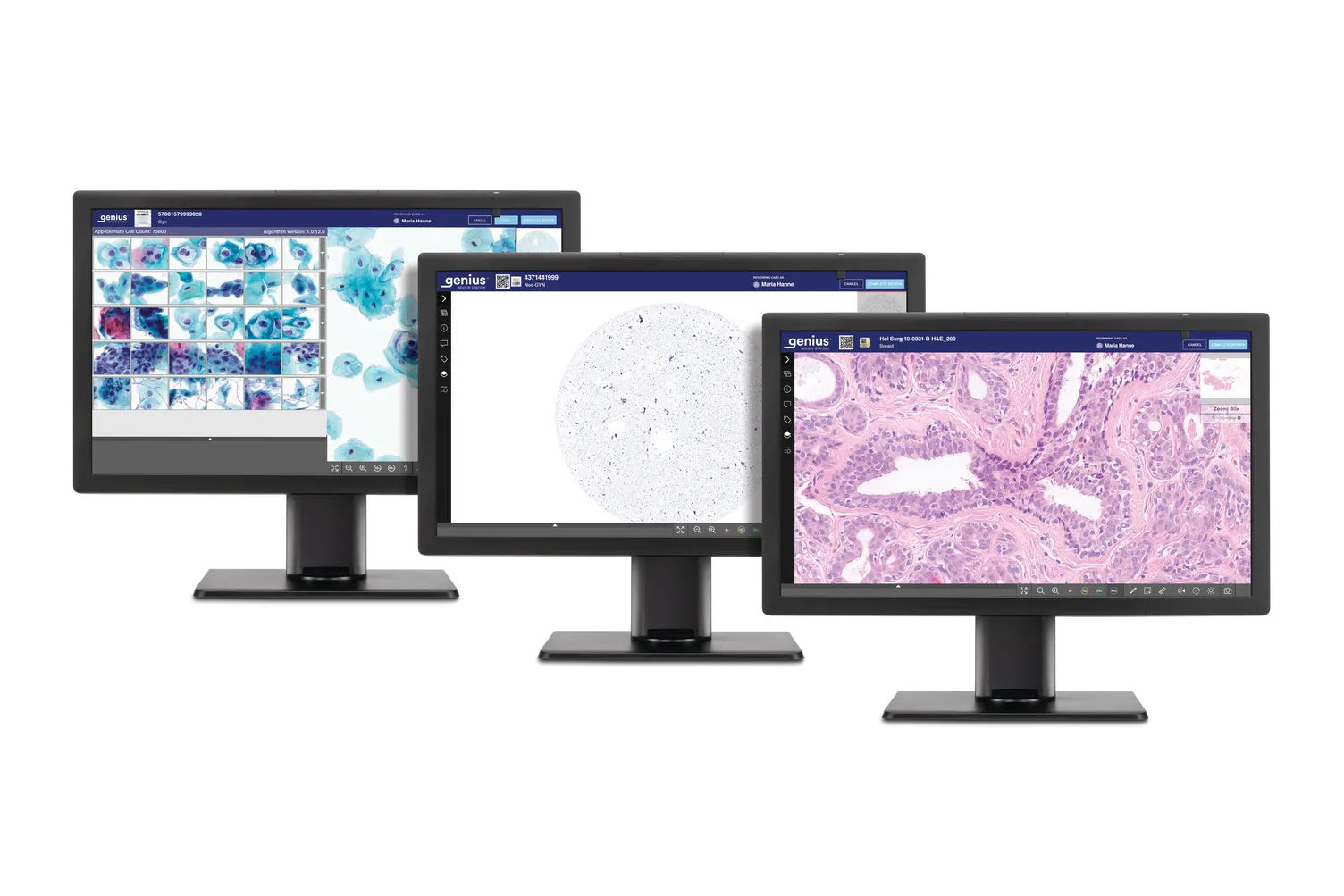 3 monitor Genius che visualizzano scansioni di istologia e citologia pronte per la revisione.