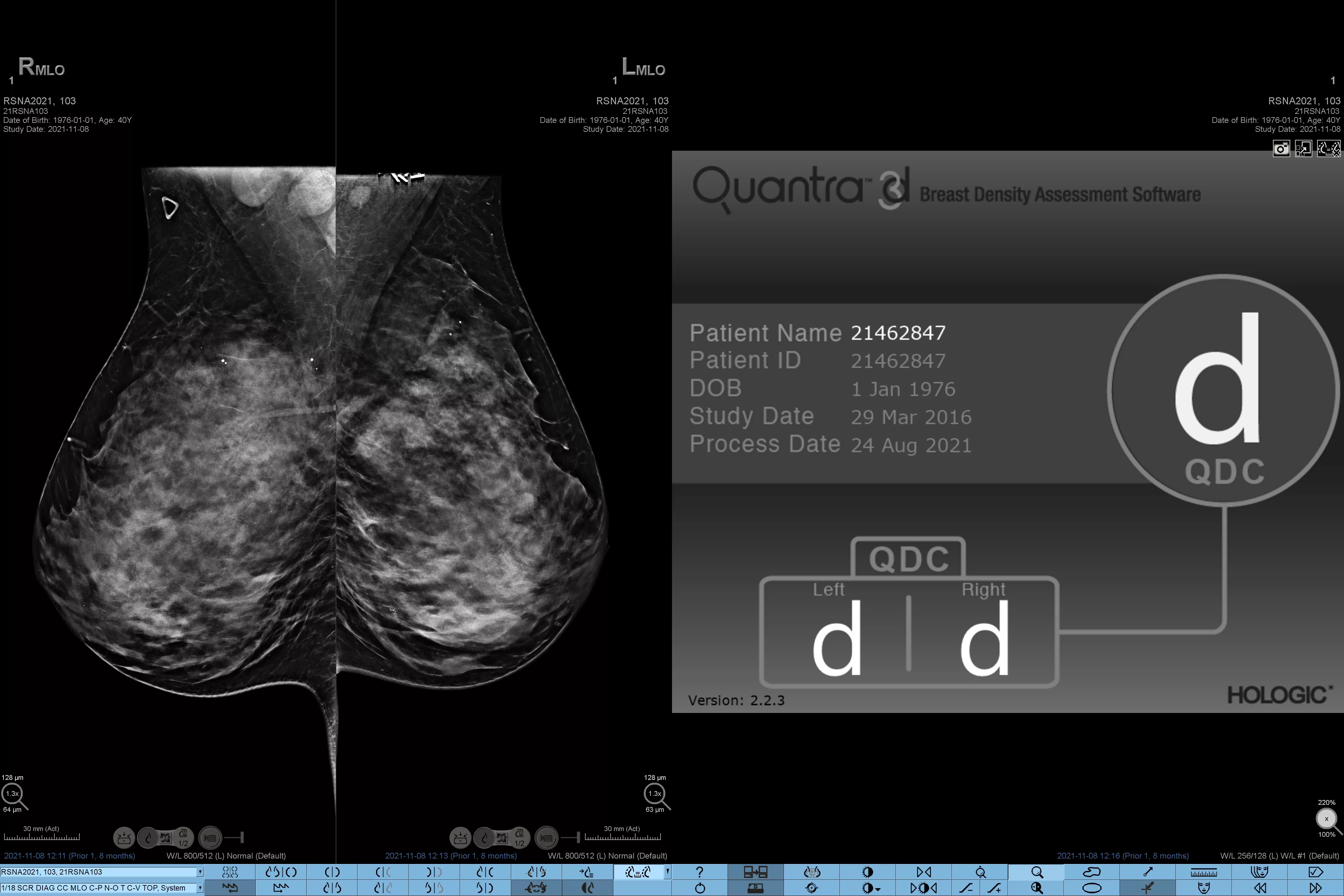 immagine radiografica