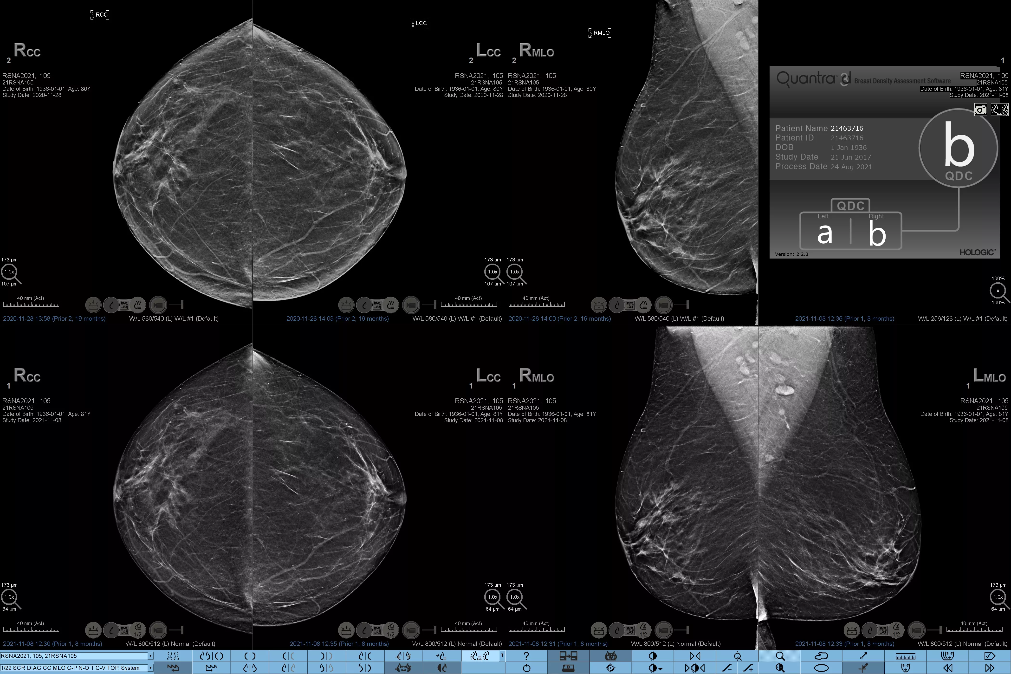 Trasduttore L18-5 su sfondo bianco