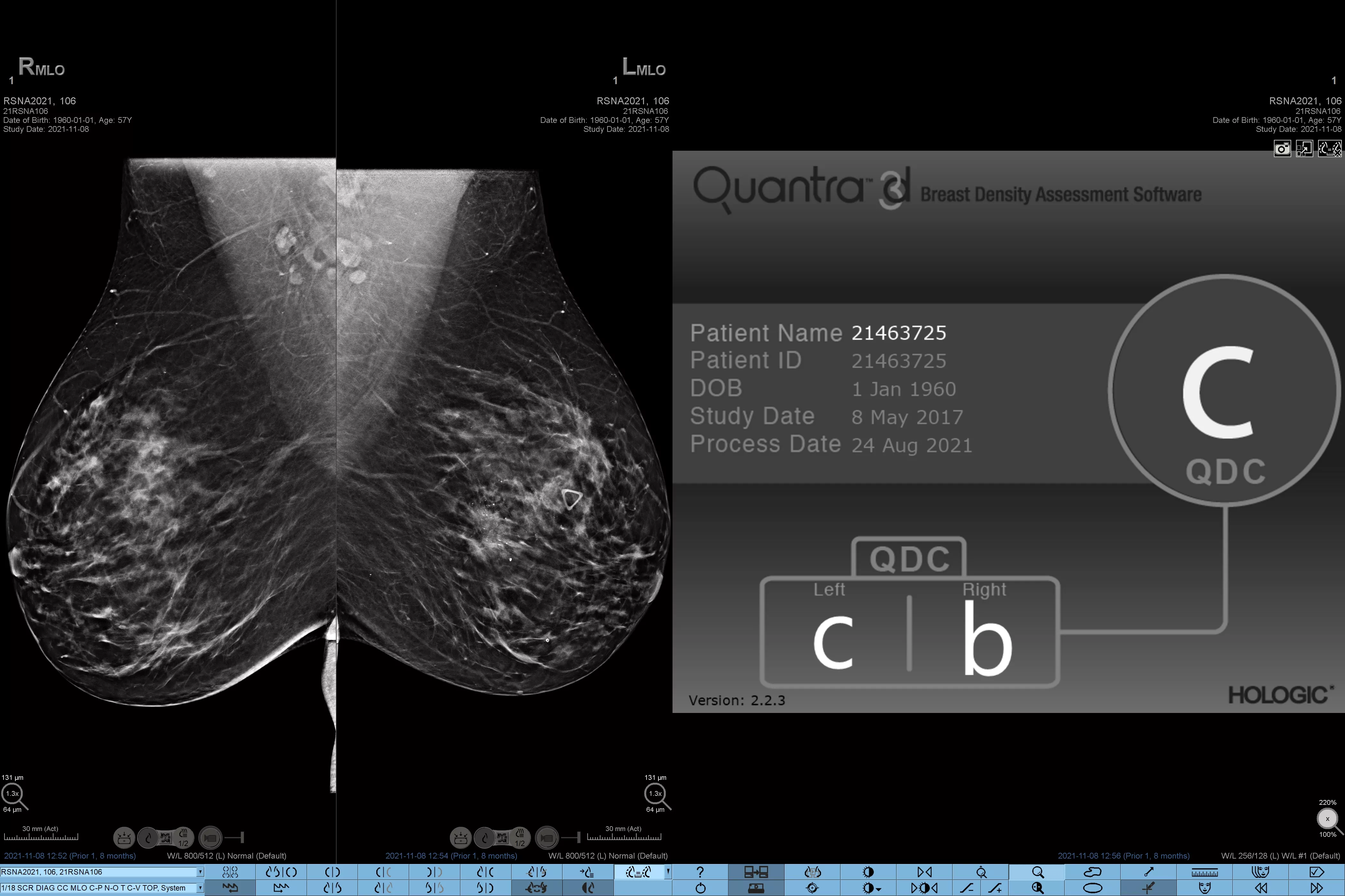 immagine radiografica