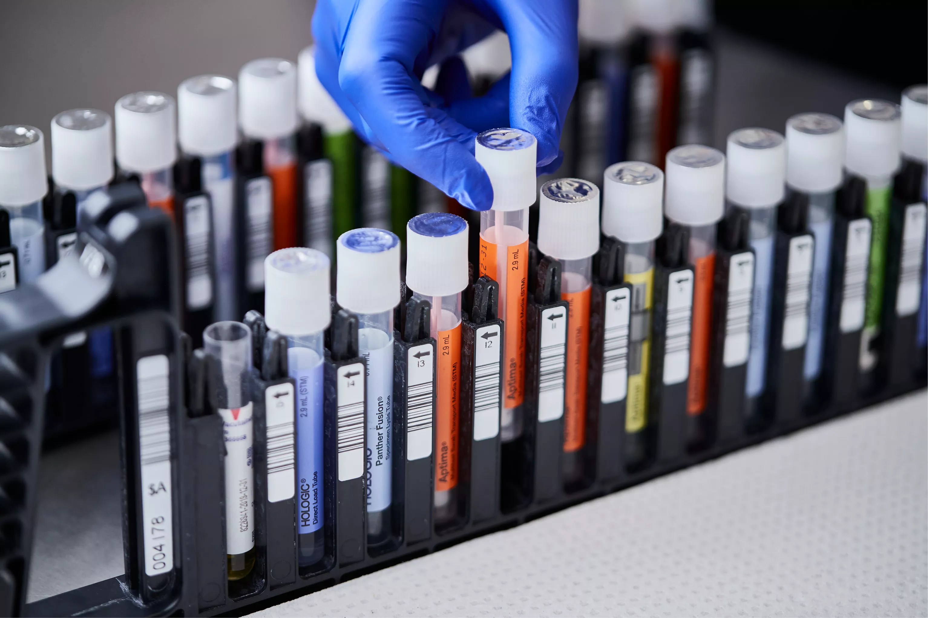 Mano con guanto che estrae una provetta da un vassoio