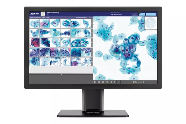 Immagine del monitor del sistema Genius