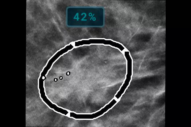 immagine radiografica