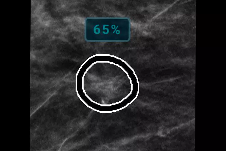 immagine radiografica