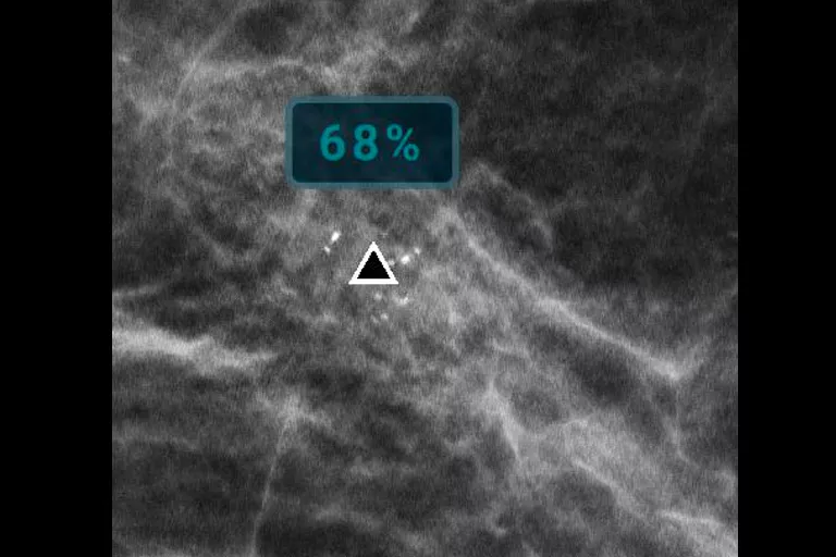 immagine radiografica