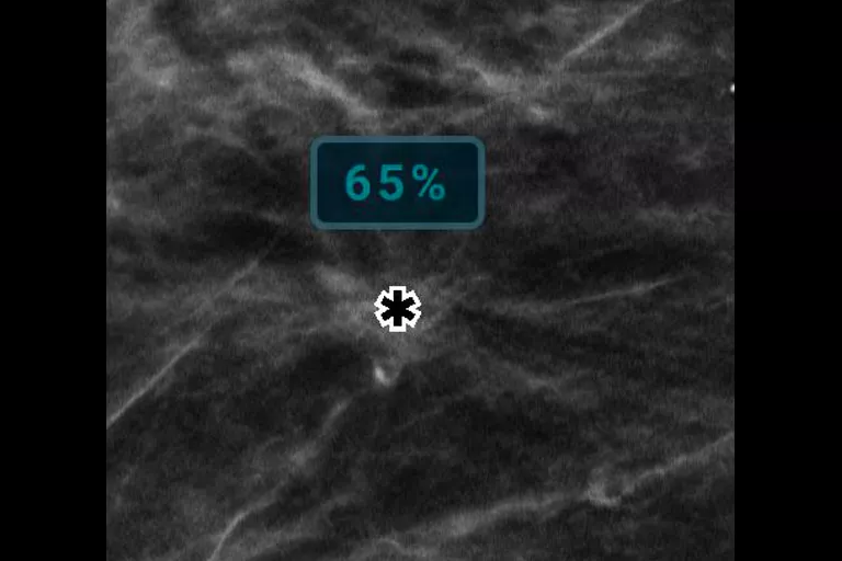 immagine radiografica