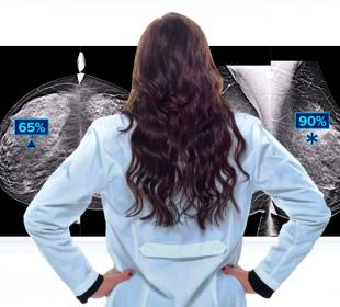 Medico che esamina immagini della Tecnologia di Genius AI™ Detection su uno schermo