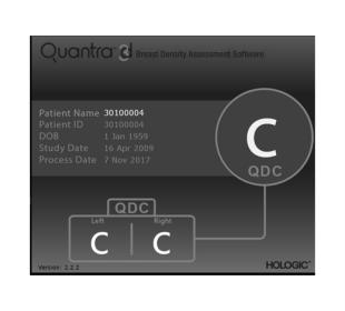 Tecnologia Quantra™ Hologic su sfondo bianco